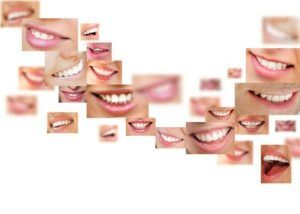 Retenedores de ortodoncia